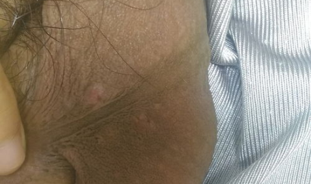 性病都有什么症状,常见类型及早期识别指南